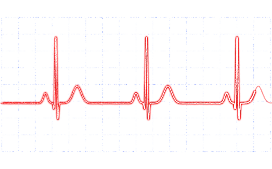 EKG-Kurve aus Lichtpunkten auf Rasterpapier